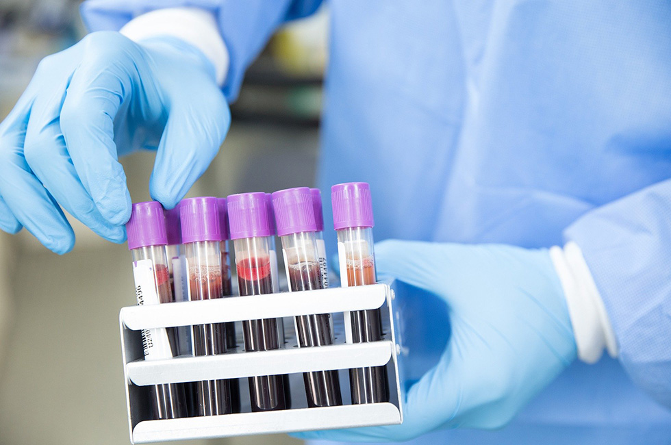 Blut-Virentest-Corona-Labor-Vogtland-Probe-Krankenkasse-Labortest-GKV